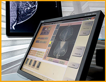 بهترین مرکز ماموگرافی در شرق تهران