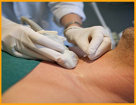 بیوپسی تیروئید چه زمانی لازم میشود؟