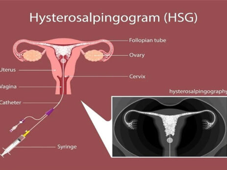 عکس رنگی رحمی خوب در شرق تهران