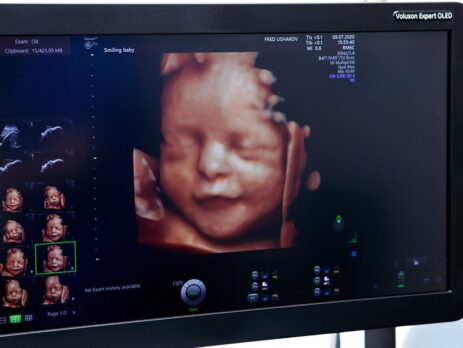 سونوگرافی آنومالی اسکن جنین در شرق تهران