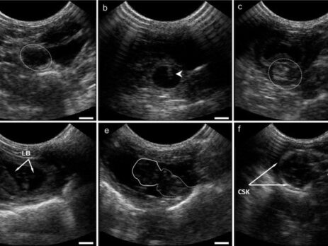 اکوکاردیوگرافی قلب جنین در مرکز سونوگرافی و رادیولوژی خورشید - شرق تهران