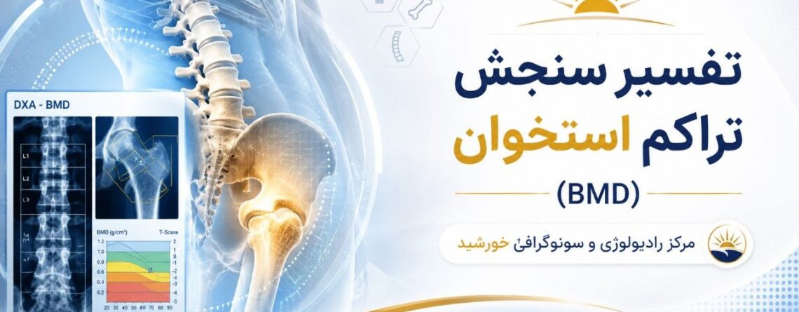 تفسیر سنجش تراکم استخوان (BMD)